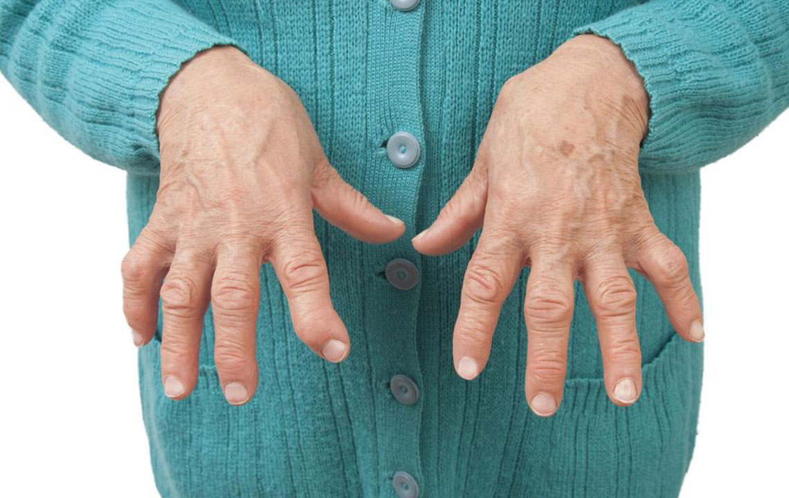 Types of arthritis and ways to deal with them